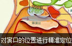 阿克苏男科医院