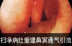 阿克苏男科医院