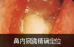 阿克苏男科医院