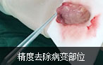 阿克苏男科医院