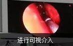 阿克苏男科医院