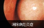 阿克苏男科医院