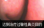 阿克苏男科医院