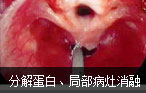 阿克苏男科医院