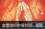 阿克苏男科医院