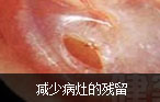 阿克苏男科医院