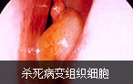 阿克苏男科医院